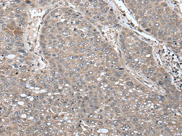 UNC45B Antibody