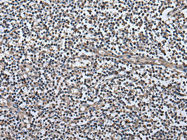 UTP3 Antibody