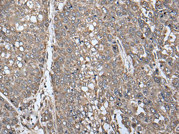 ATAD1 Antibody