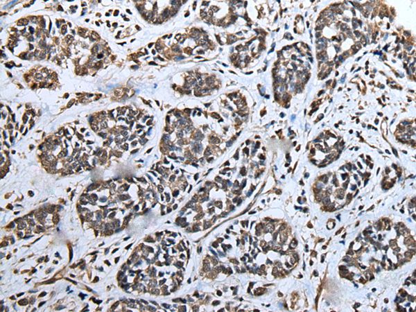 ATAD1 Antibody