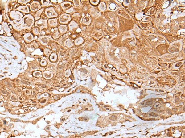IL6ST Antibody