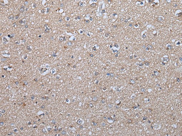 FGF5 Antibody