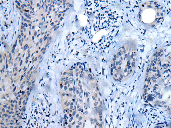 CLDN18 Antibody