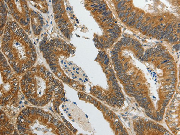 SPAG4 Antibody