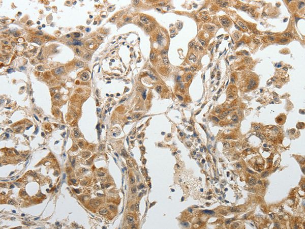 SPAG4 Antibody