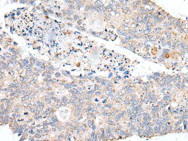 PDCD6IP  Antibody