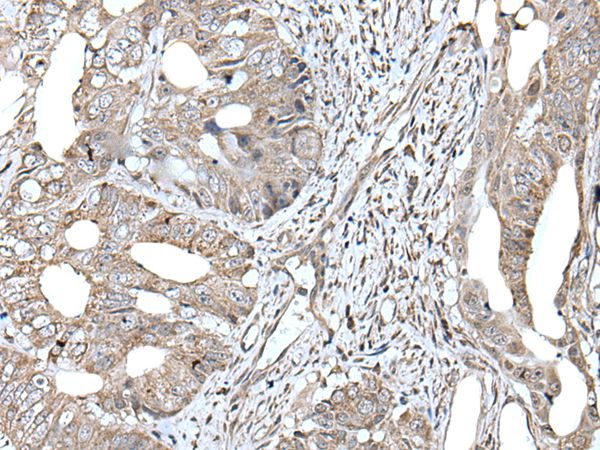 RAD54B Antibody
