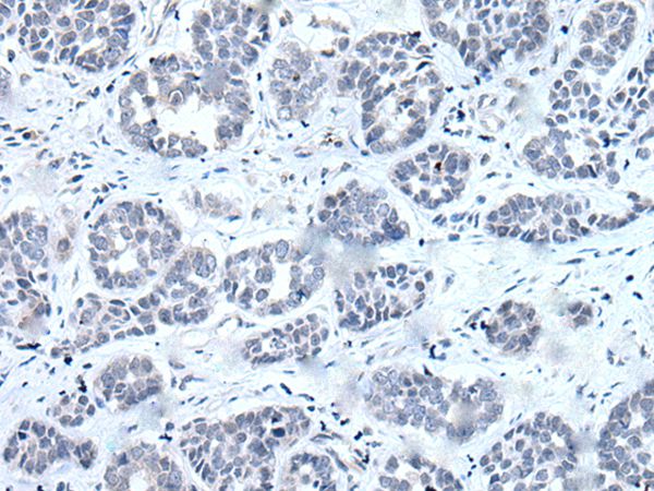 RARG Antibody
