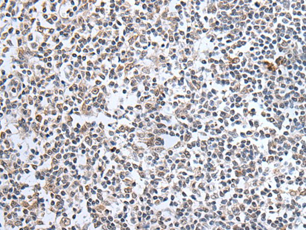 SULF2 Antibody