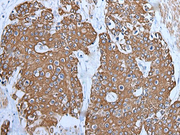 TRPC5 Antibody