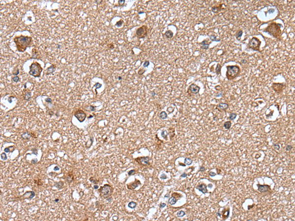 WAPL Antibody