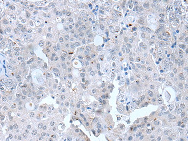CLDN12 Antibody