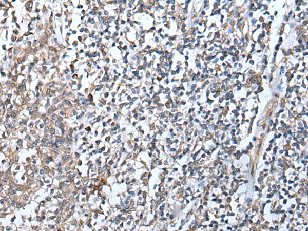 DEFB104A Antibody