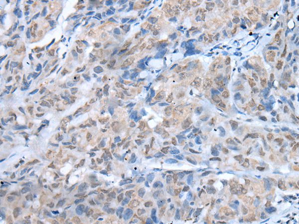 TMEM97 Antibody