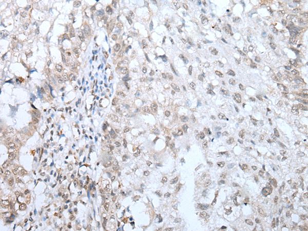 TMEM97 Antibody