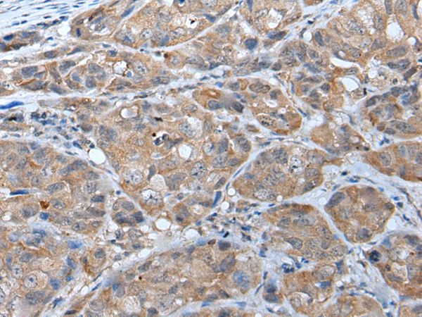 DRD2 Antibody