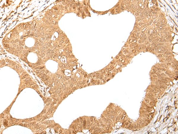KMT2B Antibody