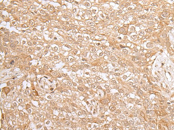 KMT2B Antibody