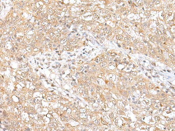 CHRNB2 Antibody