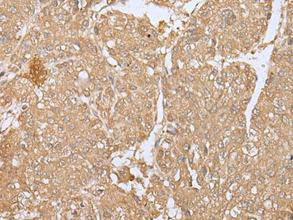 SMARCA1 Antibody