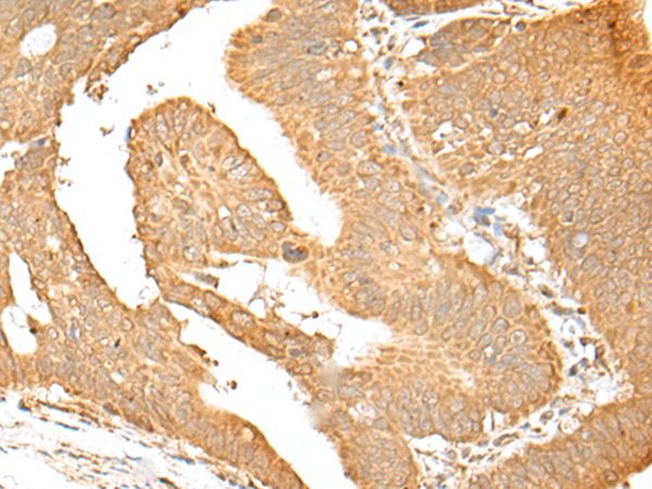 SMARCA1 Antibody