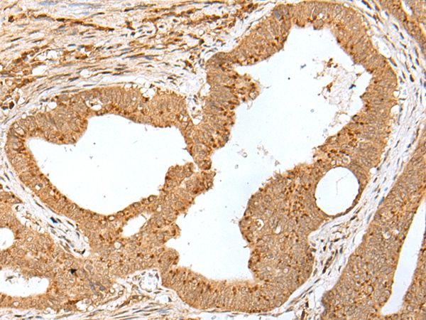 JUNB Antibody