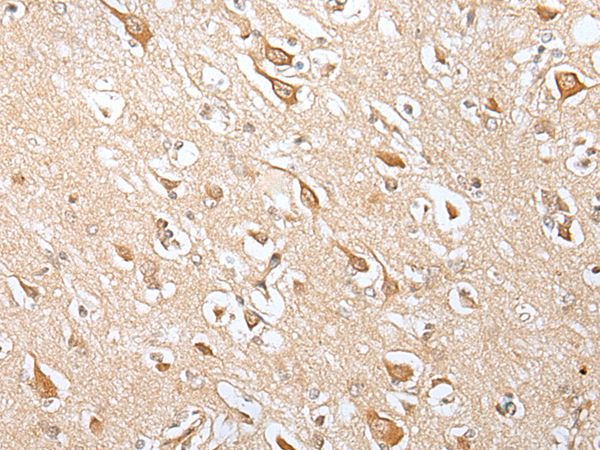 E2F3 Antibody