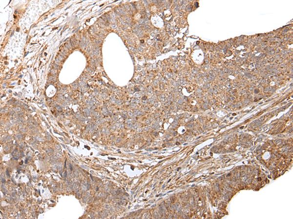 GNAI2 Antibody