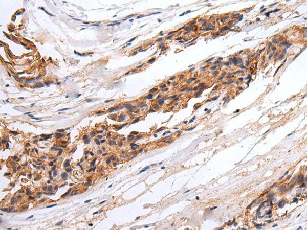 GABRR2 Antibody