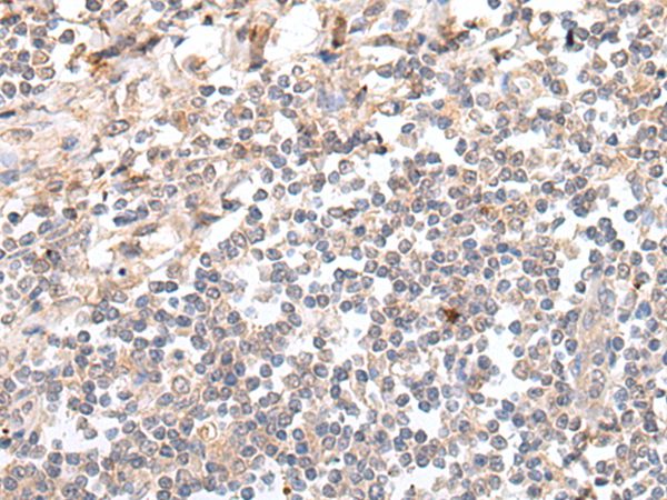 GAL Antibody