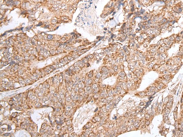 GNLY Antibody