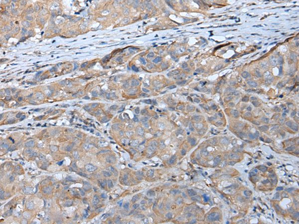 GPC5 Antibody