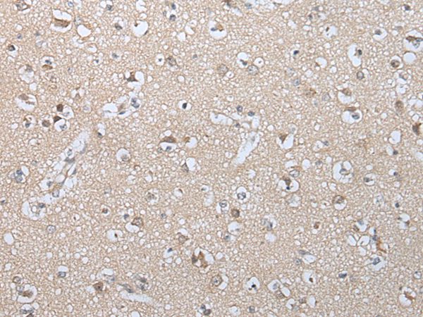 GZMM Antibody