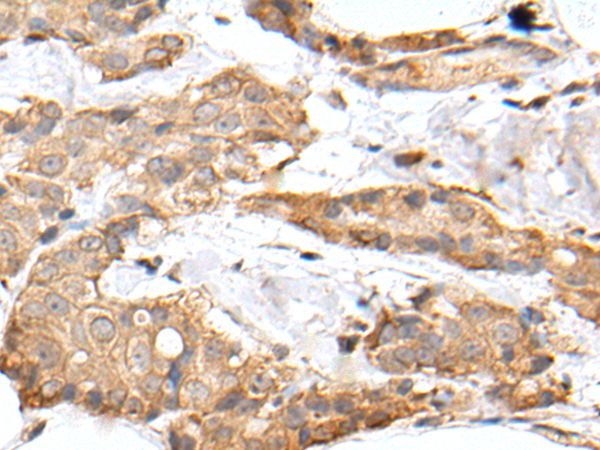 GRM4 Antibody