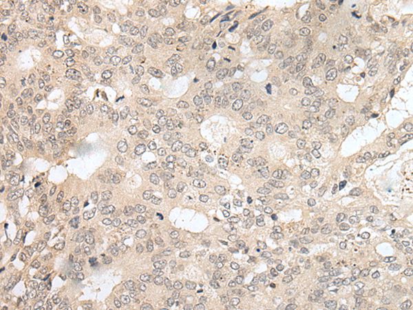 HOXA2 Antibody