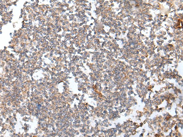 HOXB6 Antibody