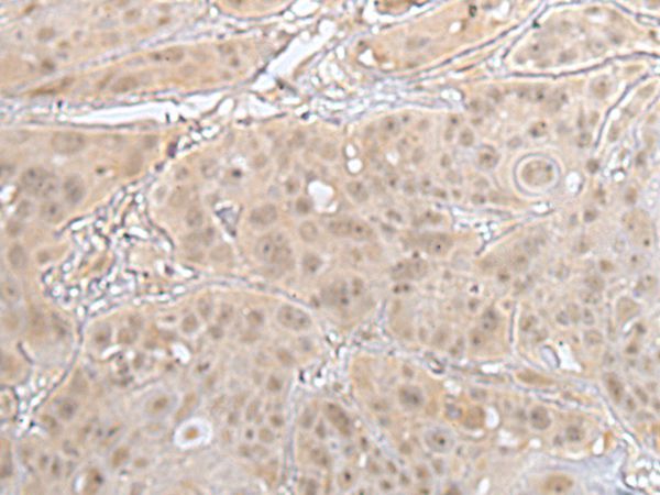 HOXD3 Antibody