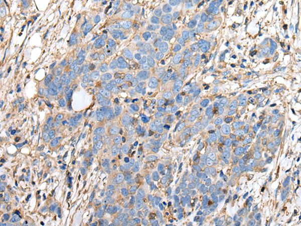 PLA2G16 Antibody
