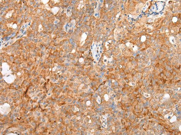 SDC2 Antibody