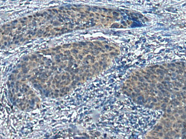 SLC16A6 Antibody