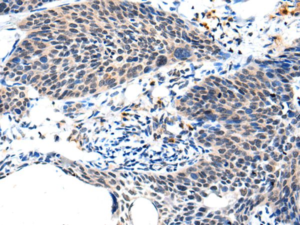 ALS2CL Antibody