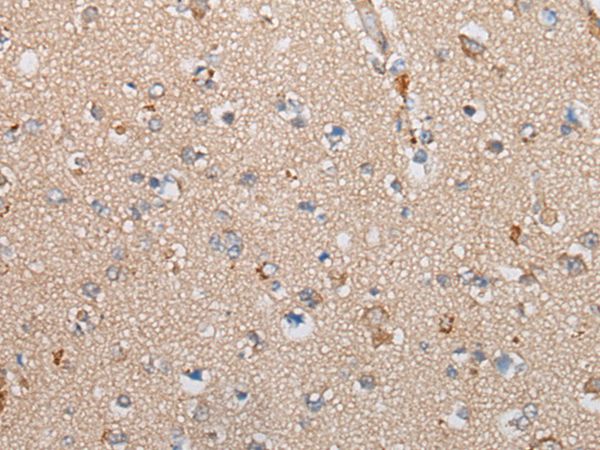 TNIK Antibody