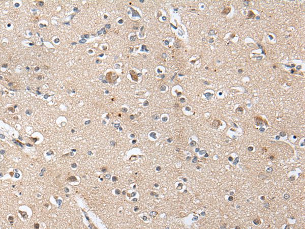 ACAN Antibody