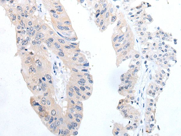 TGFB3 Antibody