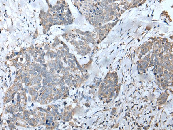 EFNB3 Antibody