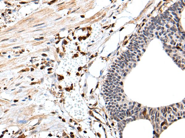 ARHGDIB Antibody