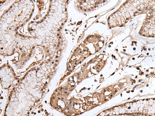 TAF1 Antibody