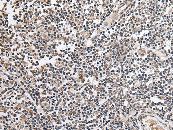KLHL4 Antibody