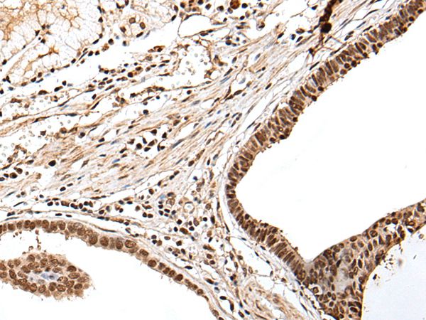 PTOV1 Antibody