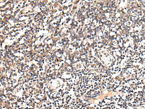 SLC12A3 Antibody